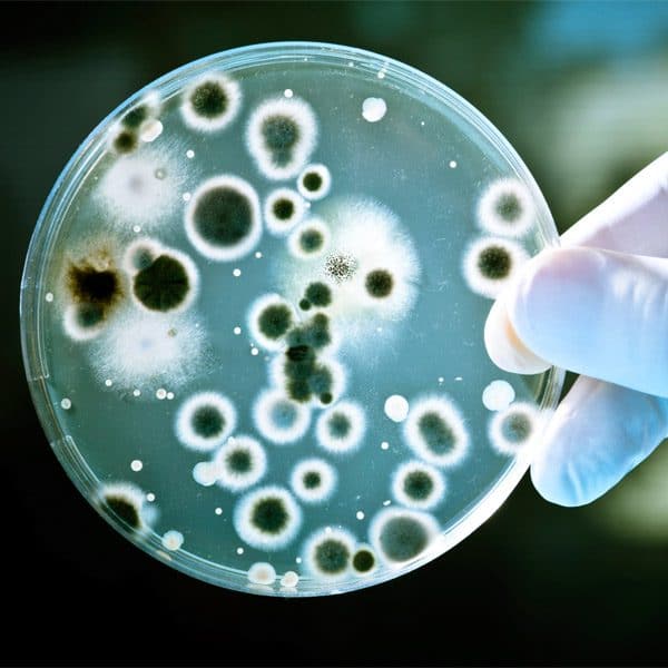 Bacteria Test Ireland
